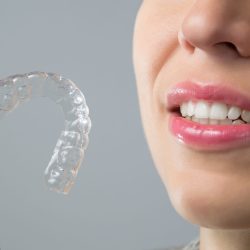 Smiling Woman with silicone trainer. Invisible braces